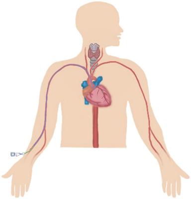 Hypothyroidism predicts worsened prognosis in patients undergoing percutaneous coronary intervention